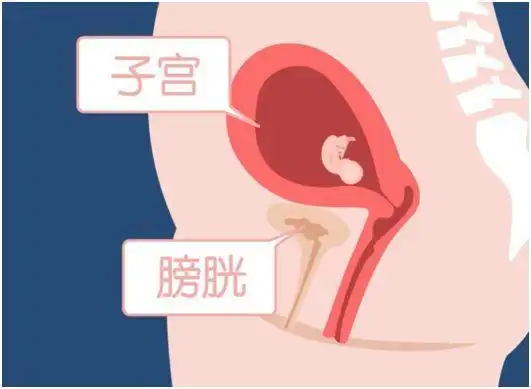 怀孕之后,宝宝在长大,子宫也跟着长大,膀胱就会受到子宫的压迫,可能