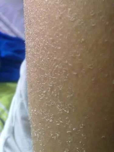 怎样科学的补水护肤?