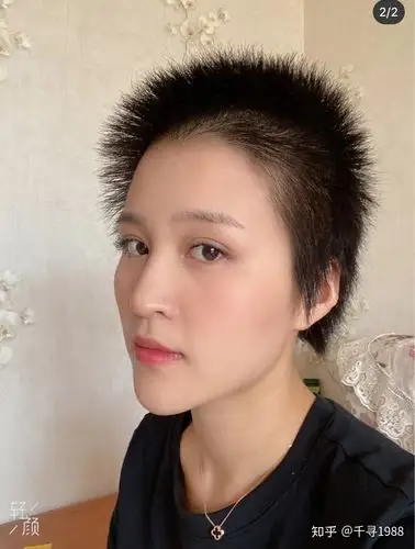 女生光头蓄发过程已更新7个月长度