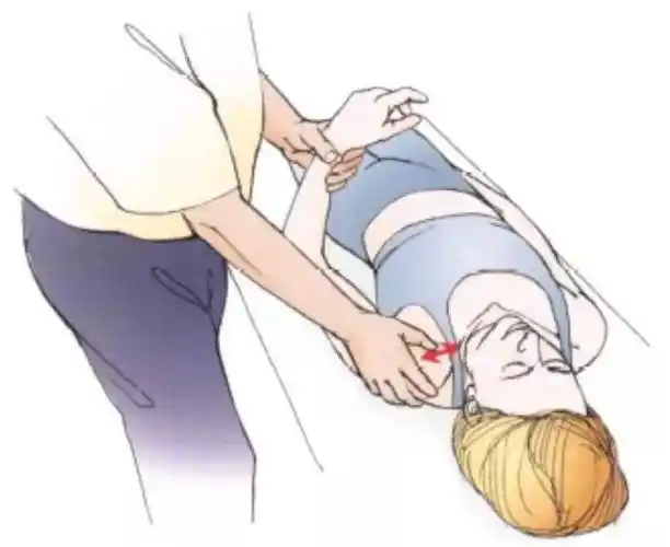 肩膀疼痛的关键肌——三角肌67_患者