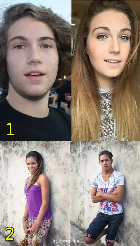 国外16位变性人的整形前后对比照,哪一位变.