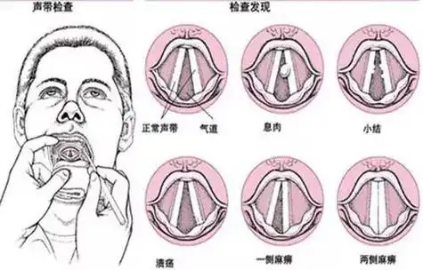 辨别方法只需一听