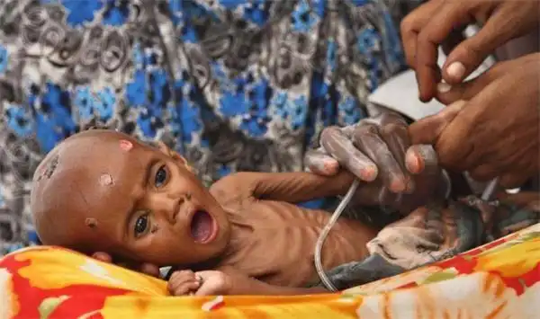 图中的这些孩子来自印度的某些部落,他们一生处在食物短缺的危机之中