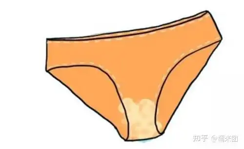 三,出现白带异常该怎么办?