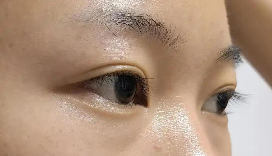 眼睛无神是啥原因