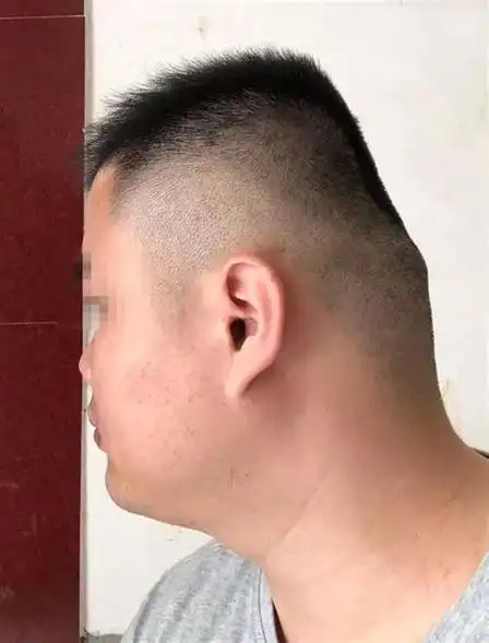 本文将讨论儿童平头睡眠的潜在危害及其可能的预防措施.