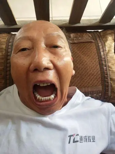 可恶的面瘫对我带来了极大的烦恼一发作我就想找到个神医在最短的时间