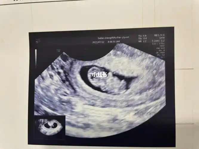 9周的宝宝小小一只