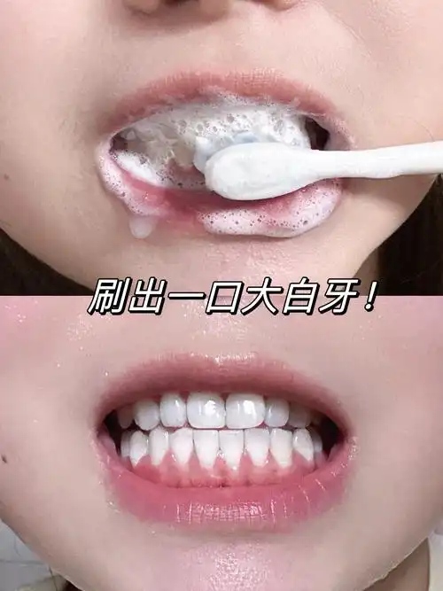 低成本刷牙把牙白回来!