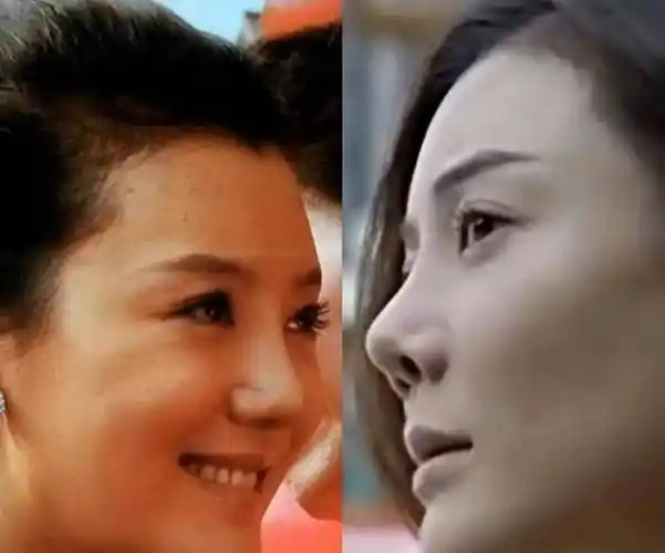这9位女星鼻子好突兀,太可惜|刘涛|秦岚|车晓|宋轶|林心如|赵丽颖|女