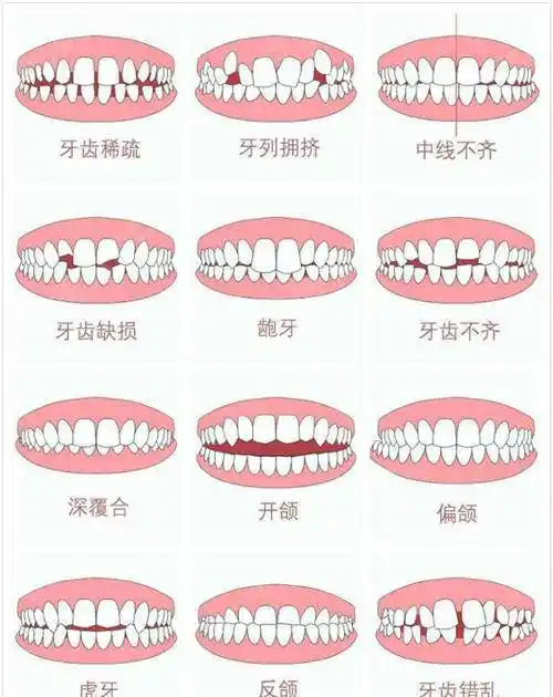 成人牙齿矫正要注意哪些