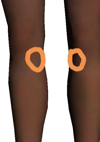 小腿内侧肌肉酸痛怎么解决(大腿和小腿肌肉酸痛是怎么回事)-友友