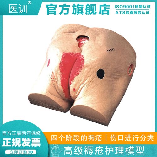 医训yx/10高级褥疮护理模型老年人基本护理技术练习四个阶段褥疮练习