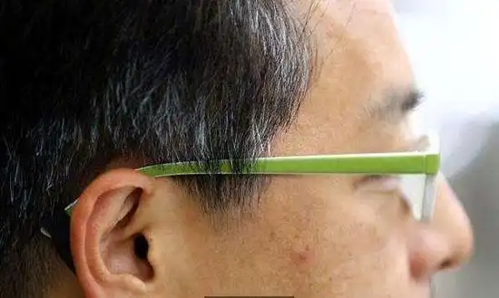 为什么头发两鬓先白头发两鬓先白是什么原因