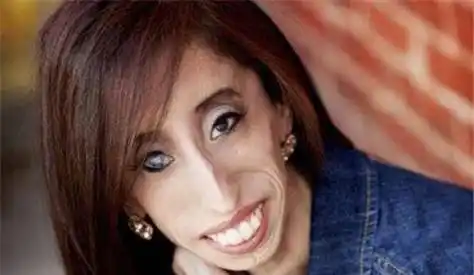 原创她出生时被人当作怪物体重只有25公斤追她的帅哥却排成长龙