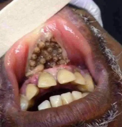 史上最恶心的图片 莲蓬乳/空手指超恶心图片合集(慎入)