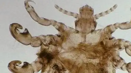 女生与同事一起洗澡,不久后发现下面长虫子,这是阴虱#阴虱 #虱子