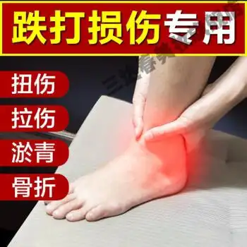 跌打损伤肌肉拉伤脚踝扭伤软组织损伤韧带拉伤摔伤踝关节外用喷剂单