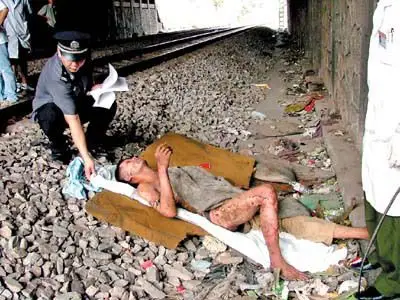 5万伏高压线击中竟大难不死(图)