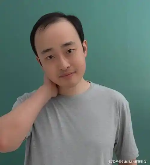 秃头大叔秒变背头男神爹妈看了差点认不出