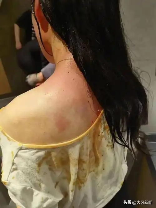 29岁女主播屡遭家暴遍体鳞伤内脏破裂,丈夫涉嫌故意伤害被刑拘,女子