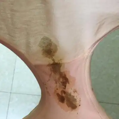 孕40周了,早上起来内裤上那麼多血,有没有事啊?是见红还是怎麼了?