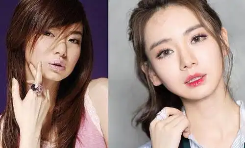 戚薇整容前后照片对比割双眼皮失败让人震惊