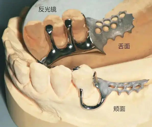 rpi卡环组的设计与应用