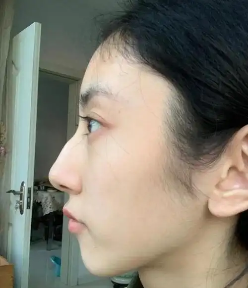 而驼峰鼻这种大上大下的弧度落差,一般人是不能够驾驭的,尤其是侧脸看