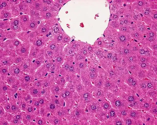 求指导肝病理切片,不知道如何描述