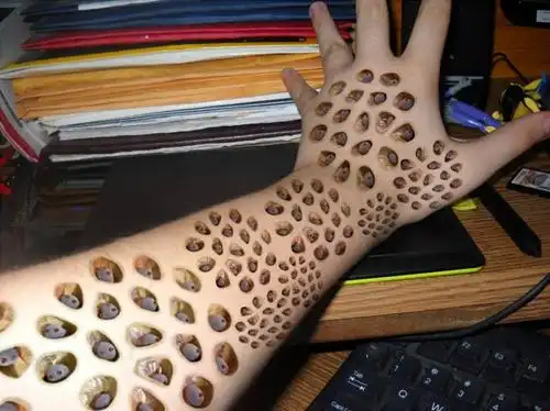 重度密集恐惧症测试图片