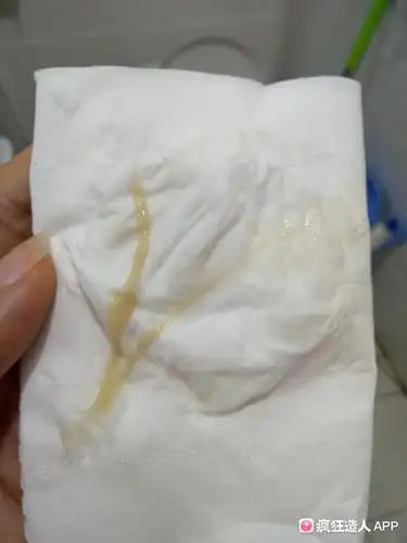 孕早期 白带褐色 有图 慎入