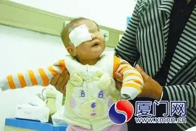 罕见!「隐眼症」宝宝天生无眼 动手术「长出右眼」