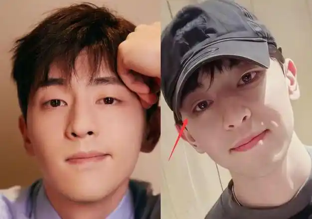 邓伦近照大变样,疑整容变双眼皮,与圈内明星一起参加婚礼成焦点