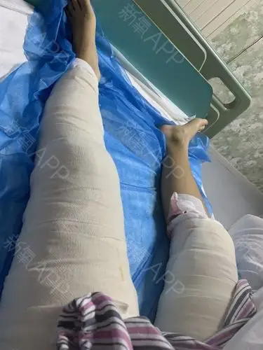 说说我的感受吧,现在的我插着尿管,下半身用绷带包裹_圈子-新氧美容