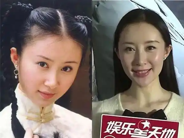 孙菲菲,整容之前也是很招人喜欢的楚楚可怜的脸,整容后看着像个假人