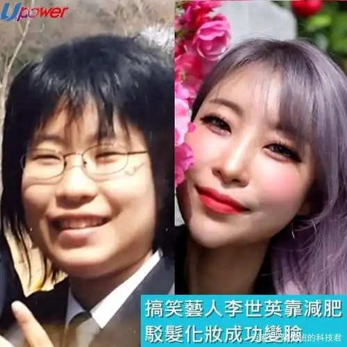 《请回答1988》李世英大方承认整形,因外貌感自卑,曾遭网友嘲笑