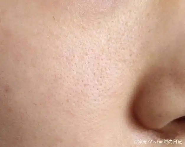 关于收缩毛孔,据说99%的人都做错了,找准原因才能对症下药