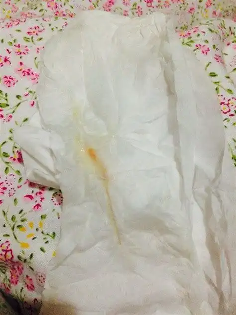 破羊水后肚子不疼最迟多久生