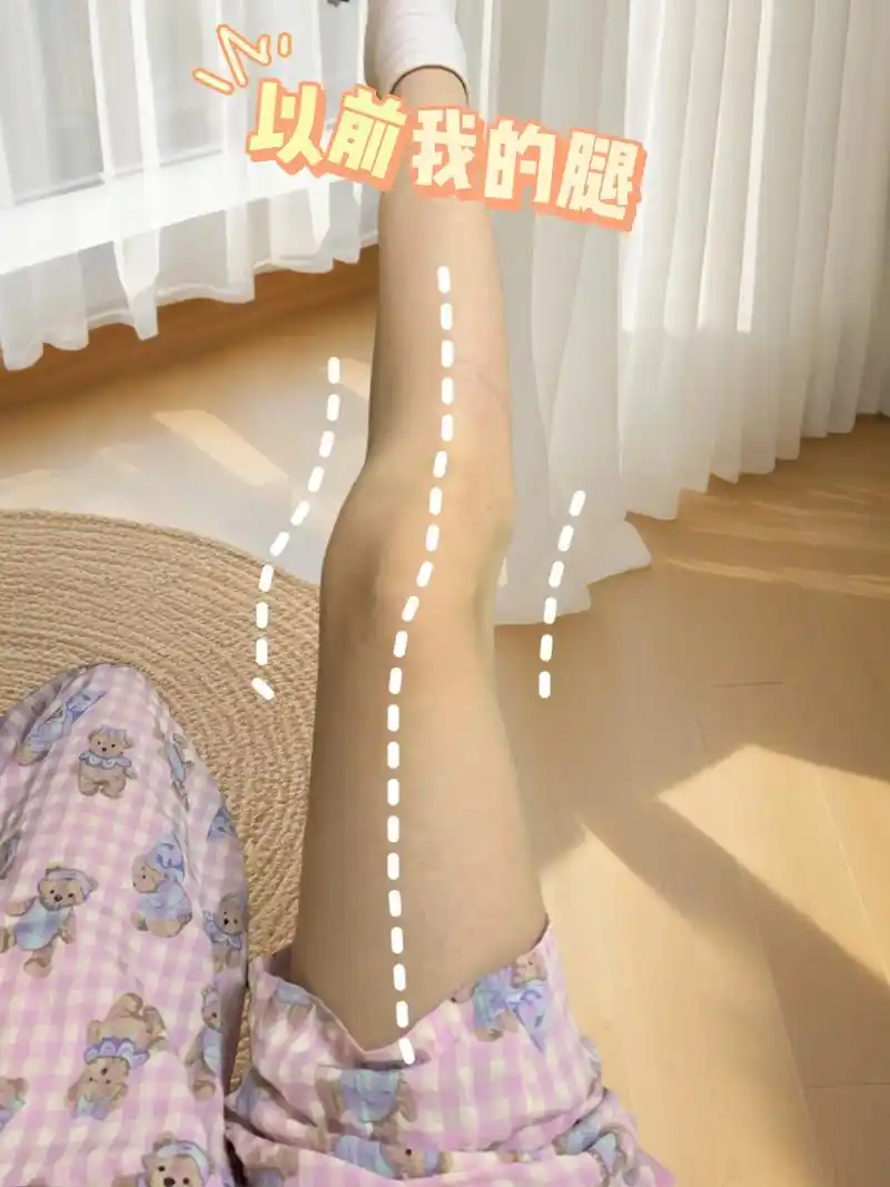 姐妹们,腿型不好的,走路姿势不正确的,可以试试.#小腿外翻# - 抖音