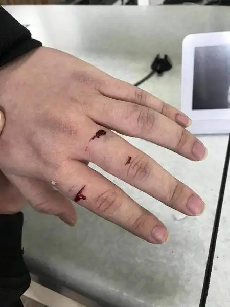 一言不合,滴滴司机竟掏出螺丝刀刺向乘客-手机新民网