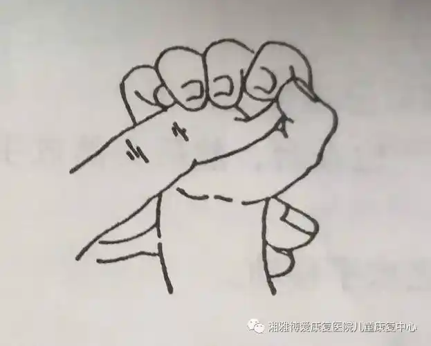 婴儿幼原始反射发育情况反映神经系统的发育水平