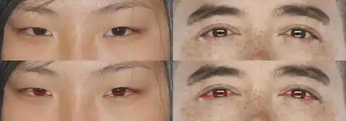 眼角高大概5度左右,负角度是老化的象征,会让面孔有种融化淌下来的