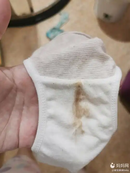 孕285今天内裤出现这种颜色的分泌物是血吗人都没有不舒服