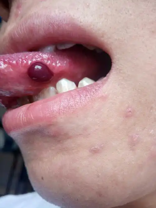 舌头上这是长了个啥?