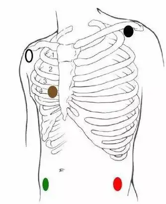 波形|心电图|电极片|血压计_网易订阅