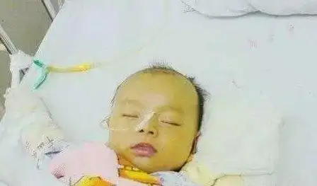 准妈妈攻略改善新生儿黄疸用它再好不过了