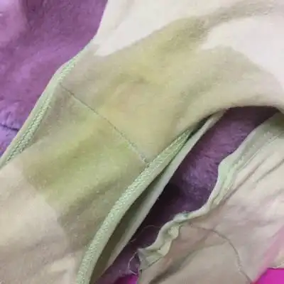 39 1了刚才流了一股子水 又没了是不是羊水破了