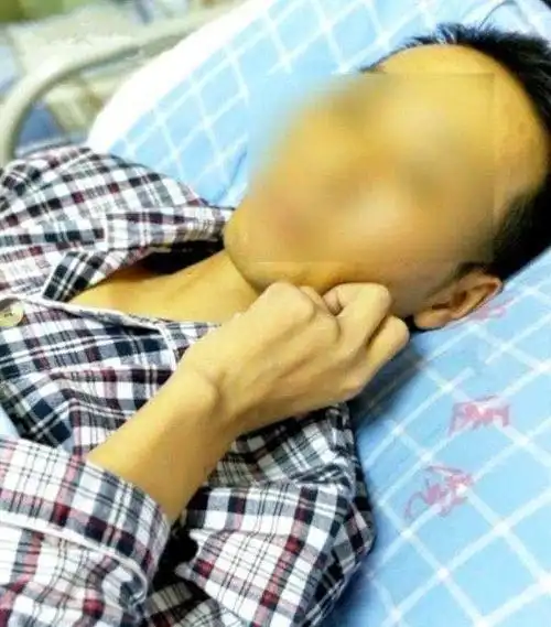 40岁夫妻全身发黄先后查出肝癌医生与妻子脱不了干系