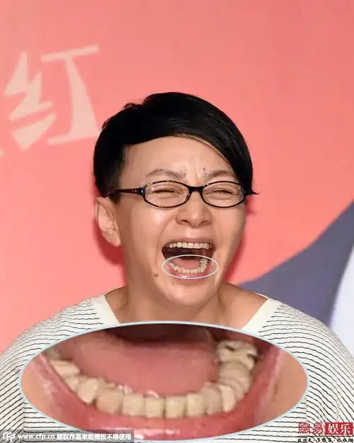 宋丹丹豪放大笑显双下巴